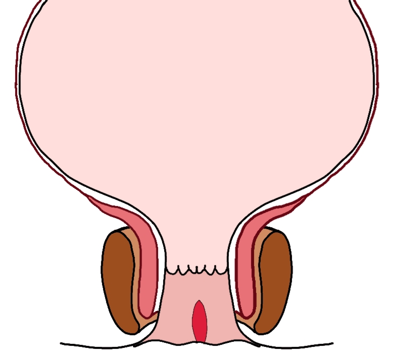Fissure anale à Lyon : Symptômes et Traitement | Chirurgie Digestive