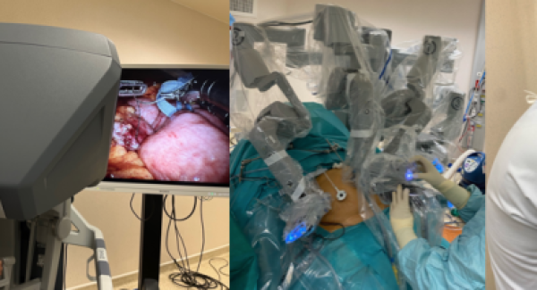 Chirurgie robotique 