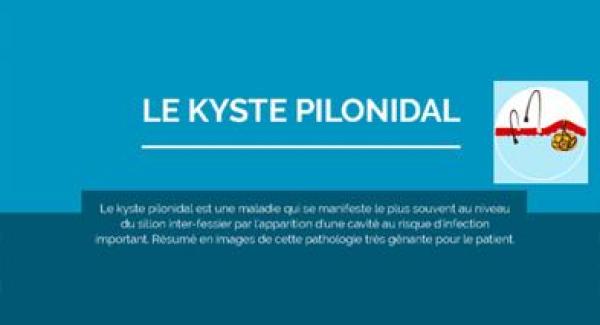 traitement par laser du kyste pilonidal